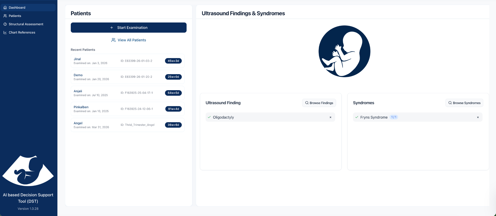 ScanOFe Fetal Structural Assessment interface showing ultrasound findings, syndromes and genes panels